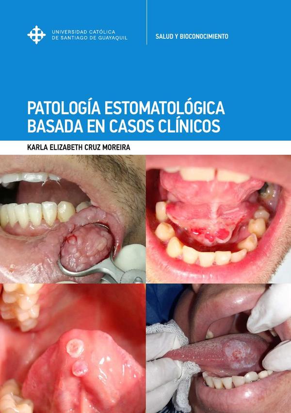 Patología Estomatológica basada en casos clínicos
