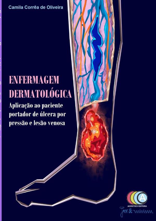 Enfermagem Dermatológica