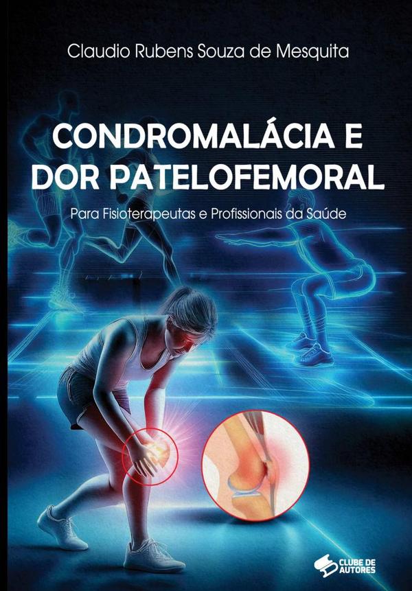 Condromalácia E Dor Patelofemoral