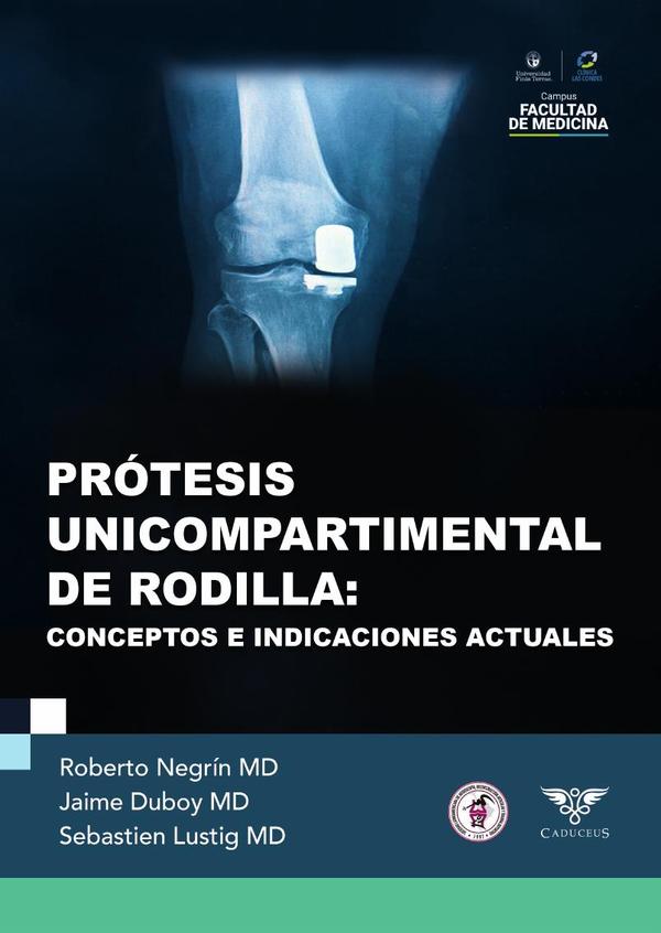 Prótesis unicompartimental de rodilla