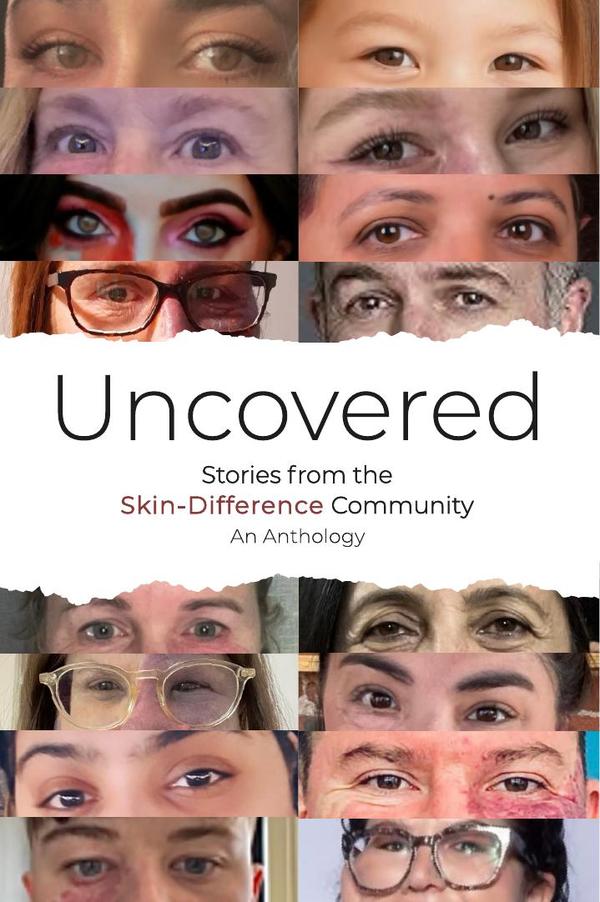 Uncovered