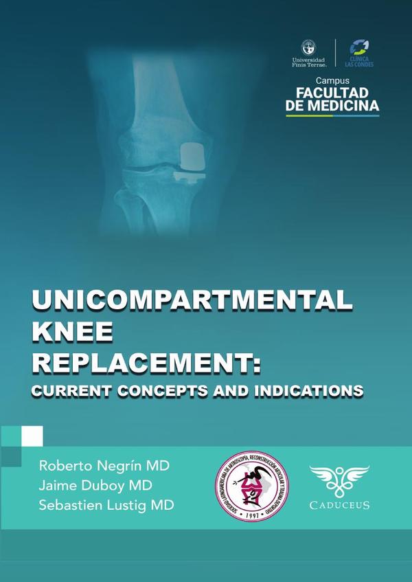 Unicompartmental knee replacement