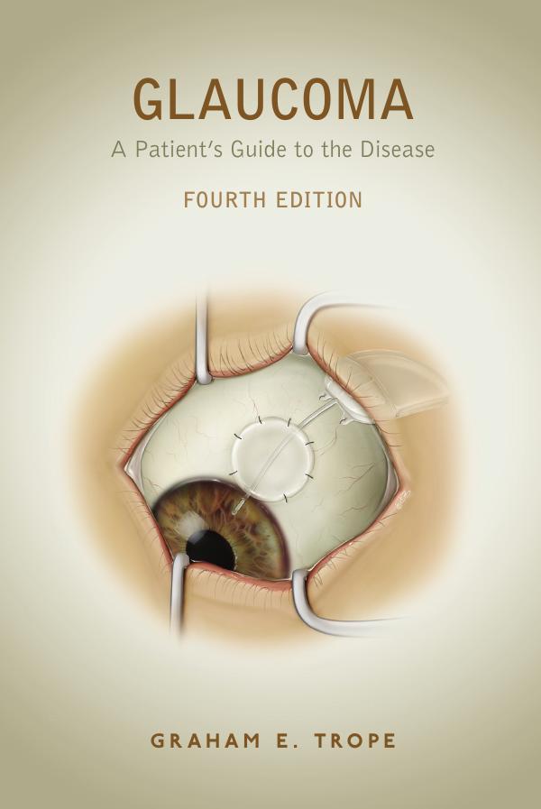GLAUCOMA, Fourth Edition